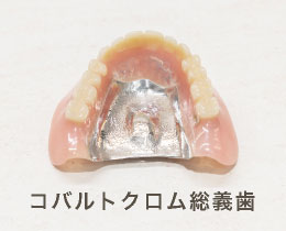 コバルトクロム総義歯