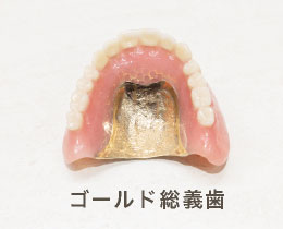 ゴールド総義歯