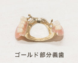 ゴールド部分義歯
