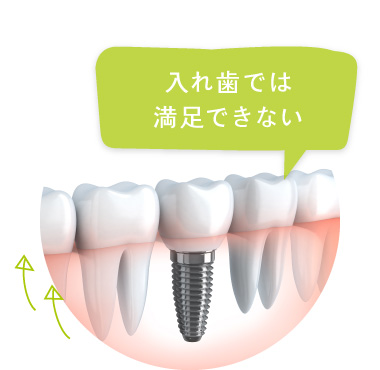 入れ歯では満足できない